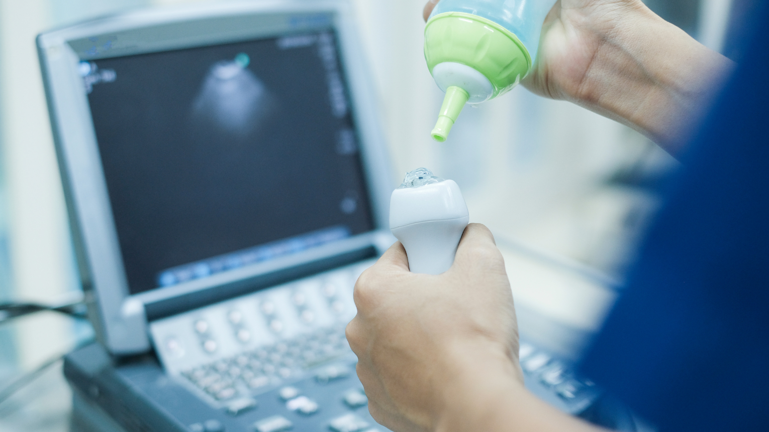 Echographie cardiaque